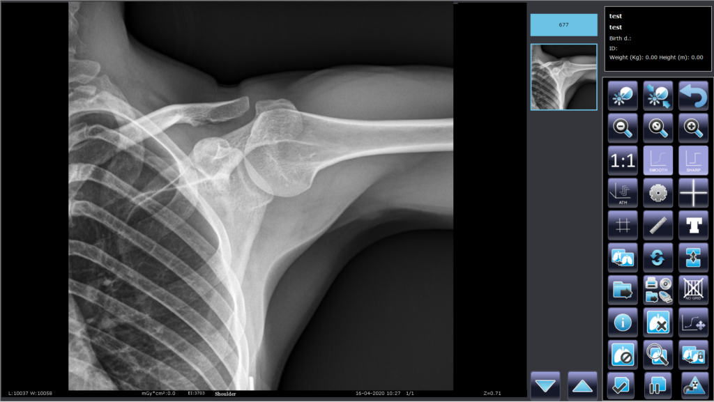 TS Primo S DR | Summit Industries AMRAD Medical X-Rays
