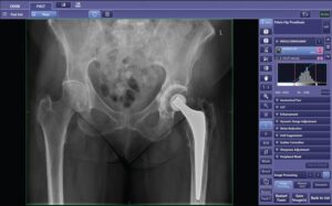 Cannon DR CXDI Software-hips