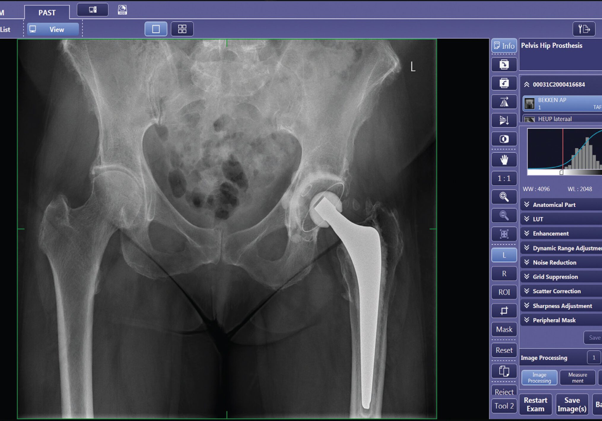 Cannon DR CXDI Software-hips