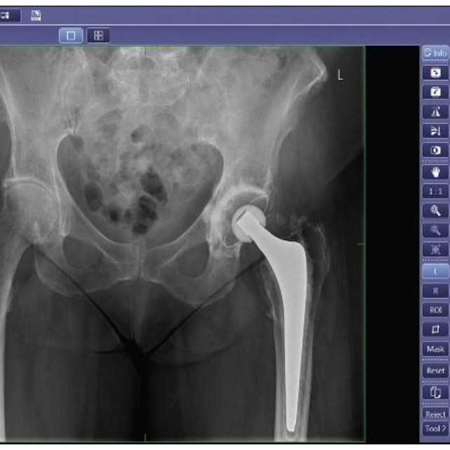 RSNA 2025 Summit Industries AMRAD Medical